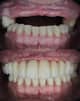 Slider image (4) Smile Atelier by Dr. Roberto Tamara - Dental Clinic in Colombia